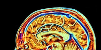 The In-Car MRI