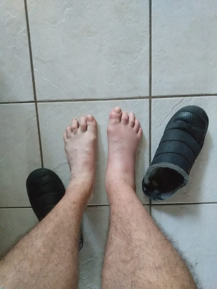 bout gout